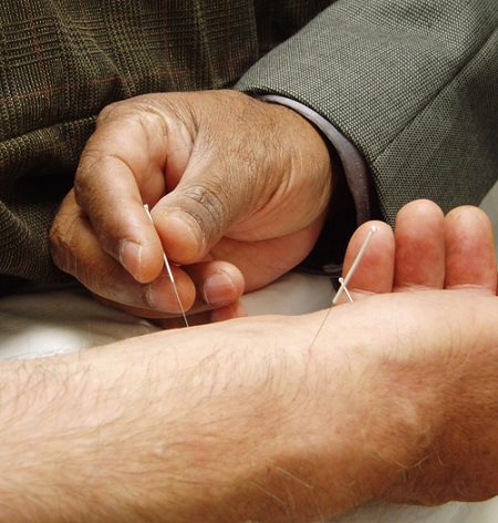 acupuncture. alert1 medical alert systems